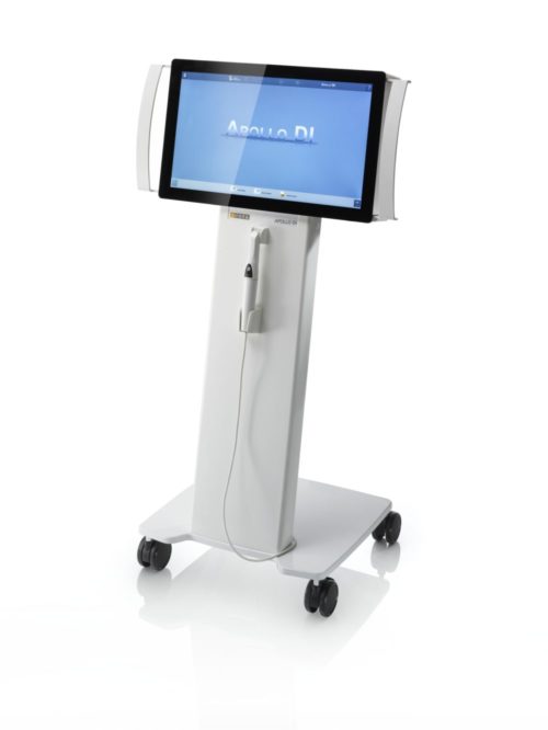 Digital dental impression scanner
