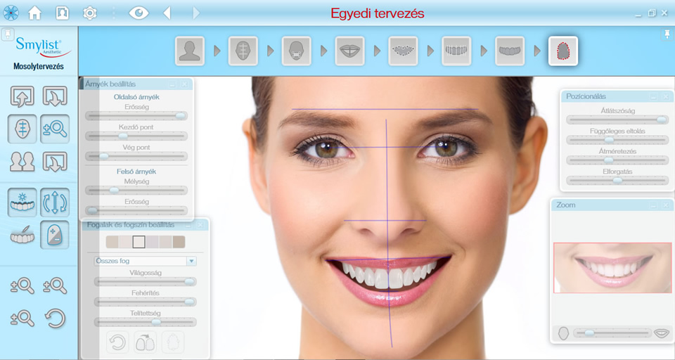 Smylist software at HD-dental Hungary