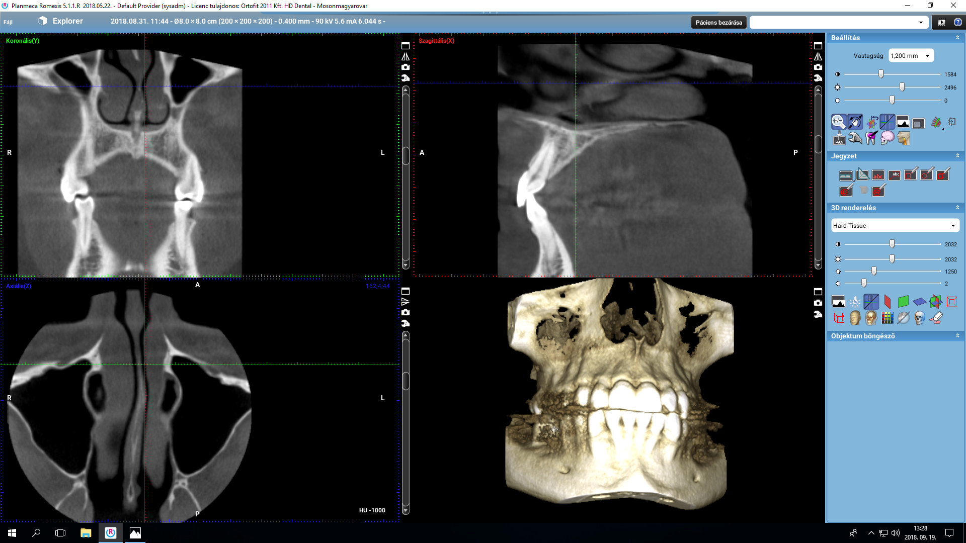 3D Zahnröntgen Planmeca Aufnahme – Hightech-Geräte bei HD-Dental