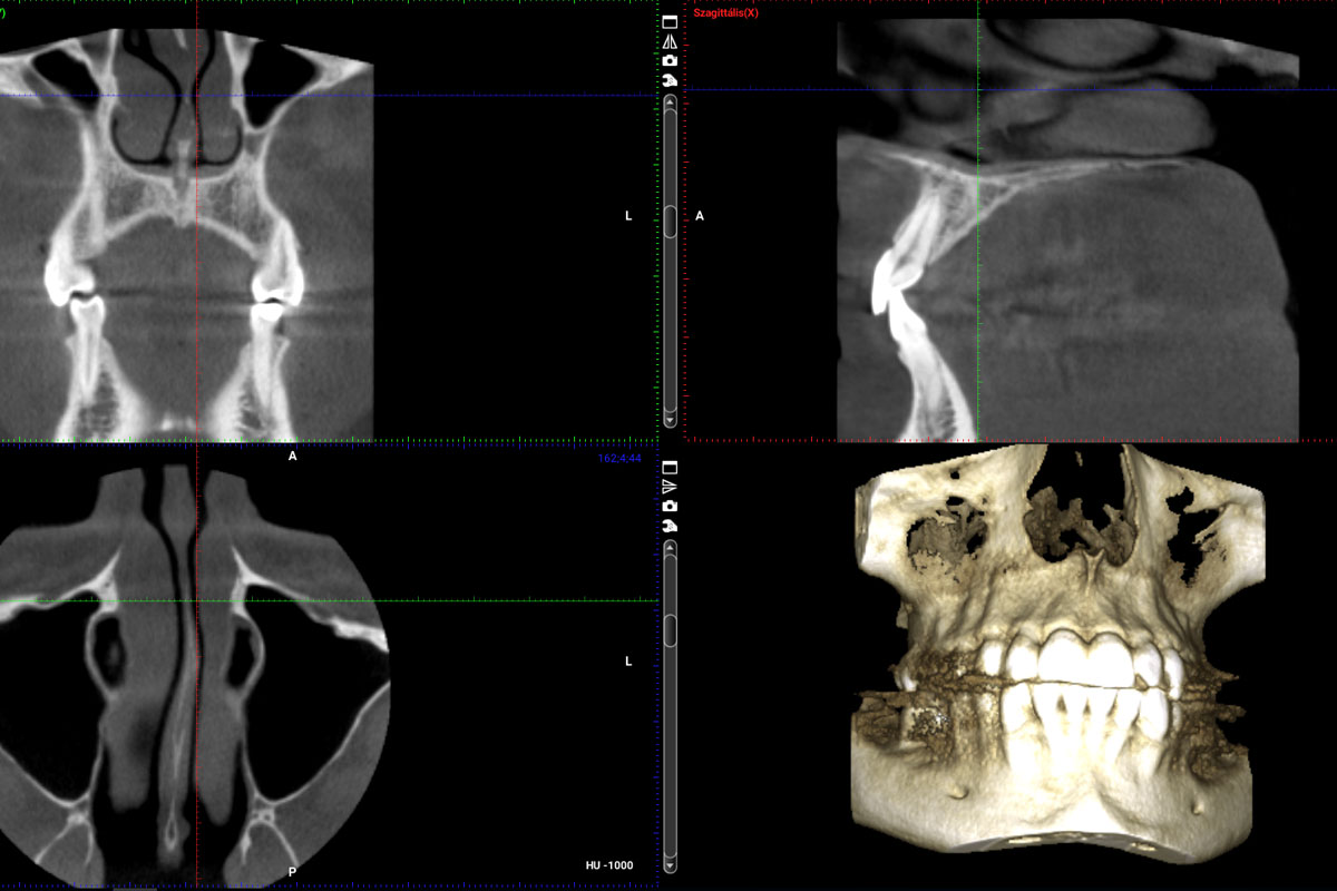 Dental X-ray in 3-D with Planmeca ProMax